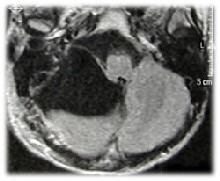 Cistiaracnpost-op1.jpg