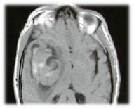 RMN T1 ass I.jpg